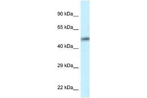 Western Blot showing CAMK2D antibody used at a concentration of 1 ug/ml against HT1080 Cell Lysate (CAMK2D anticorps  (C-Term))