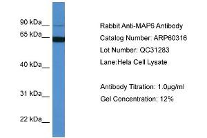 WB Suggested Anti-MAP6  Antibody Titration: 0. (MAP6 anticorps  (N-Term))