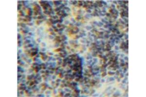 Used in DAB staining on fromalin fixed paraffin-embedded Spleen tissue (BID anticorps  (AA 1-195))