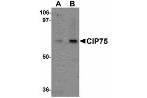 Image no. 1 for anti-Ubiquilin 4 (UBQLN4) (N-Term) antibody (ABIN478130) (UBQLN4 anticorps  (N-Term))