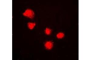 Immunofluorescent analysis of BMI1 staining in K562 cells. (BMI1 anticorps)