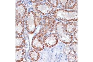 Immunohistochemistry of paraffin-embedded rat kidney using CLPP Rabbit mAb (ABIN1682296, ABIN3017596, ABIN3017597 and ABIN7101508) at dilution of 1:100 (40x lens).