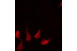 ABIN6267577 staining HepG2 by IF/ICC. (XIAP anticorps  (pSer87))