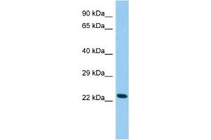 Host: Rabbit Target Name: Cdo1 Sample Type: Rat Testis lysates Antibody Dilution: 1.