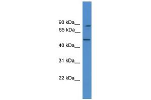 WB Suggested Anti-ZER1 Antibody Titration: 1. (ZER1 anticorps  (Middle Region))