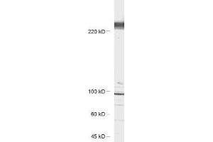 antibody dilution: 1 : 1000, sample: rat hippocampus lysate (CACNA1B anticorps)