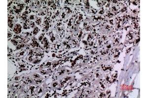 Immunohistochemistry (IHC) analysis of paraffin-embedded Human Breast, antibody was diluted at 1:100. (HSP90 anticorps  (acLys284, acLys292))