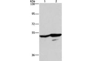Western Blot analysis of A431 and K562 cell using GPR39 Polyclonal Antibody at dilution of 1:200 (GPR39 anticorps)