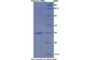 SDS-PAGE analysis of Human PML Protein.
