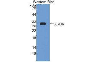 Western blot analysis of the recombinant protein. (ATP1B4 anticorps  (AA 132-356))
