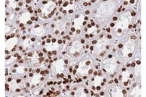 ABIN6267010 at 1/100 staining human Kidney tissue sections by IHC-P.