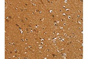 The image on the left is immunohistochemistry of paraffin-embedded Human brain tissue using ABIN7192401(SLC16A3 Antibody) at dilution 1/30, on the right is treated with synthetic peptide. (SLC16A3 anticorps)