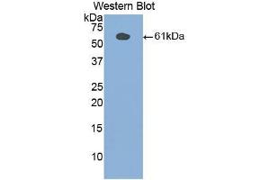 Western blot analysis of the recombinant protein. (PLAA anticorps  (AA 534-792))