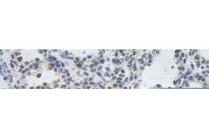 Rabbit Anti-DDX17 Antibody       Paraffin Embedded Tissue:  Human alveolar cell   Cellular Data:  Epithelial cells of renal tubule  Antibody Concentration:   4.