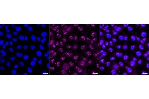 Immunocytochemical staining of HT- cells with Proteasome activator subunit 1 antibody (ABIN7799957), 1:1,000). (Recombinant LACBIDRAFT 301065 anticorps  (Subunit 1))