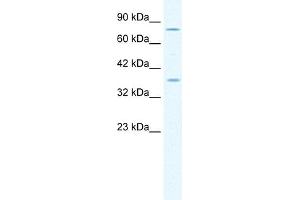 WB Suggested Anti-MCM4 Antibody Titration:  1. (MCM4 anticorps  (Middle Region))