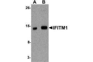 Western blot analysis of IFITM1 in 3T3 cell lysate with IFITM1 antibody at (A) 1 and (B) 2 μg/ml.