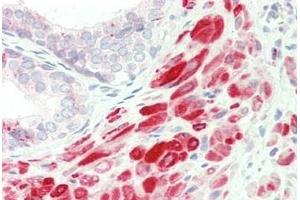 Human, Prostate: Formalin-Fixed Paraffin-Embedded (FFPE)