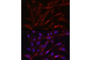 Immunofluorescence analysis of U2OS cells using TIMP2 Rabbit pAb (ABIN3022132, ABIN3022133, ABIN1513608, ABIN1514751 and ABIN6218618) at dilution of 1:250 (40x lens). (TIMP2 anticorps  (AA 100-200))