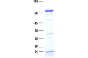 Validation with Western Blot