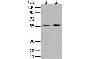 Western Blotting (WB) image for anti-PiggyBac Transposable Element Derived 2 (PGBD2) antibody (ABIN2422351) (PGBD2 anticorps)