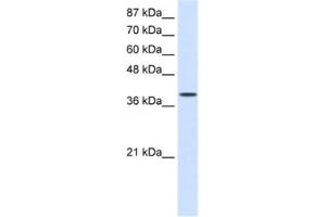 Western Blotting (WB) image for anti-Eukaryotic Translation Initiation Factor 4 gamma 2 (EIF4G2) antibody (ABIN2462107) (EIF4G2 anticorps)