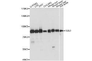 Western blot analysis of extracts of various cell lines, using G2E3 antibody. (G2E3 anticorps)