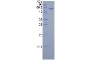 Image no. 1 for Adiponectin Receptor 1 (ADIPOR1) (AA 1-136) (Active) protein (His tag,GST tag) (ABIN6239829) (Adiponectin Receptor 1 Protein (ADIPOR1) (AA 1-136) (His tag,GST tag))