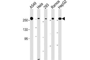 All lanes : Anti-FASN Antibody (Center) at 1:500-1:2000 dilution Lane 1: A549 whole cell lysate Lane 2: Hela whole cell lysate Lane 3: 293 whole cell lysate Lane 4: Ramos whole cell lysate Lane 5: HepG2 whole cell lysate Lysates/proteins at 20 μg per lane. (Fatty Acid Synthase anticorps  (AA 942-973))
