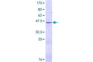 Image no. 1 for Dihydrofolate Reductase (DHFR) (AA 1-187) protein (GST tag) (ABIN1351537)