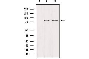 Western blot analysis of extracts from various samples, using NCKIPSD Antibody.