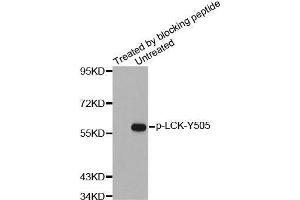 Western blot analysis of extracts from JK cells using Phospho-LCK-Y505 antibody and the same antibody preincubated with blocking peptide.