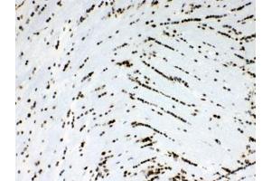 IHC testing of FFPE rat brain tissue with Musashi antibody at 1ug/ml.