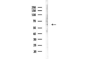 anti-Periphilin 1 (PPHLN1) (N-Term) antibody