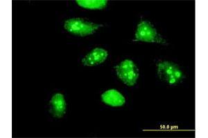 Immunofluorescence of purified MaxPab antibody to HSPC111 on HeLa cell.