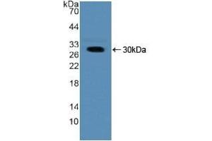 Detection of Recombinant NUP50, Human using Polyclonal Antibody to Nucleoporin 50 kDa (NUP50) (NUP50 anticorps  (AA 37-269))