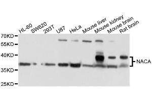 Western blot analysis of extracts of various cell lines, using NACA antibody. (NACA anticorps  (AA 1-215))