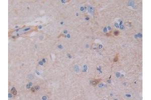 Detection of TNFSF9 in Human Cerebrum Tissue using Polyclonal Antibody to Tumor Necrosis Factor Ligand Superfamily, Member 9 (TNFSF9)