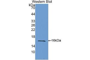 Western blot analysis of the recombinant protein. (Galectin 9 anticorps  (AA 194-322))