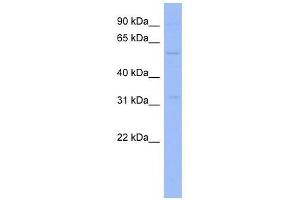 ZNF266 antibody used at 0. (ZNF266 anticorps  (Middle Region))