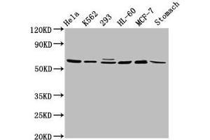 Western Blot Positive WB detected in: Hela whole cell lysate, K562 whole cell lysate, 293 whole cell lysate, HL60 whole cell lysate, MCF-7 whole cell lysate, Rat stomach tissue All lanes: GATAD2A antibody at 2. (GATAD2A anticorps  (AA 170-241))