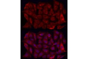 Immunofluorescence analysis of U2OS cells using MMP7 Rabbit pAb (ABIN3021102, ABIN3021103, ABIN3021104, ABIN1513214 and ABIN6213952) at dilution of 1:350 (40x lens).