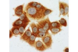 ICC testing of MCF-7 cells (MEK1 anticorps  (C-Term))