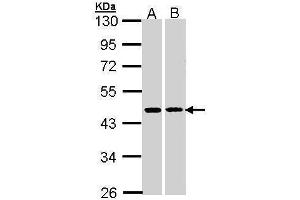 WB Image HSD3B2 antibody [N3C3] detects HSD3B2 protein by Western blot analysis. (HSD3B2 anticorps)