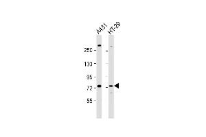All lanes : Anti-K6 Antibody (Center) at 1:1000 dilution Lane 1: A431 whole cell lysate Lane 2: HT-29 whole cell lysate Lysates/proteins at 20 μg per lane.
