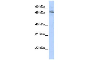 WB Suggested Anti-TRIM6 Antibody Titration:  0. (TRIM6 anticorps  (Middle Region))