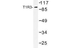 Image no. 1 for anti-Taste Receptor, Type 1, Member 3 (TAS1R3) antibody (ABIN317869) (TAS1R3 anticorps)