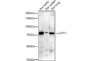 Western blot analysis of extracts of various cell lines, using GFPT1 antibody (ABIN7267430) at 1:1000 dilution. (GFPT1 anticorps)
