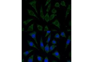 Immunofluorescence analysis of L929 cells using C2 Polyclonal Antibody (ABIN7265549) at dilution of 1:100 (40x lens).