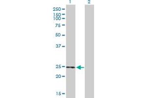 Western Blot analysis of THEM5 expression in transfected 293T cell line by THEM5 MaxPab polyclonal antibody. (THEM5 anticorps  (AA 1-247))
